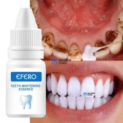 Teeth whitening essence - Buy in Malawi