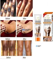 Dark knuckle whitening cream - Buy in Malawi